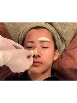 顔脱毛がしたい