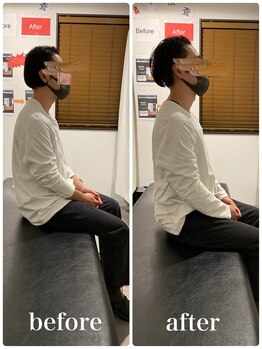 ナオル整体 新宿院(NAORU整体)/30代男性-猫背矯正 3ヶ月経過