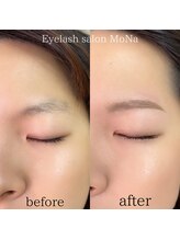 モナ(MoNa)/まつ毛パーマ＋美眉WAX脱毛