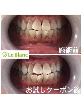 ルブラン 奈良店(Le Blanc)/歯のお悩みなど