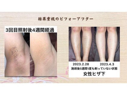 美意識の写真