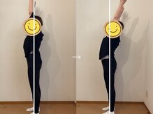 ナチュウェイ(Natuway)/施術例【高崎/整体】