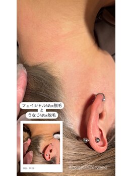 レガリア(LEGAREA)/