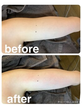 ギンザアール(GINZA R.)/平日お得に痩身ケア♪