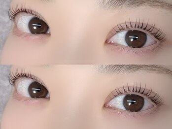 ミコ 天神大名店(mico)の写真/【完全個室のプライベート空間】周りの目を気にせず施術が受けられる♪相談が気軽にできるのも嬉しい☆