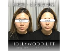 ブリリオプラス 四条烏丸店(Brillio plus)/