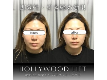 ブリリオプラス 四条烏丸店(Brillio plus)/