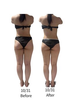 ララナ バイ カノア(LALANA by kanoa)/お尻小さくなった！