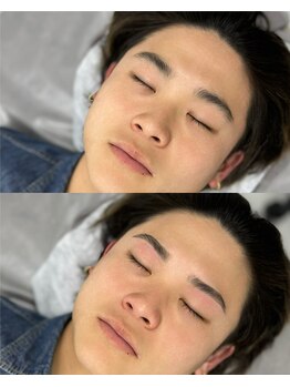 メンズリバース 横浜店/BEFORE/AFTER