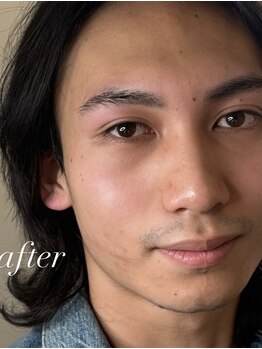 ダウニー(Downy)/20代/男性/会社員
