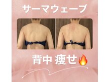プリマプリート 可児店/背中をすっきりさせたい！