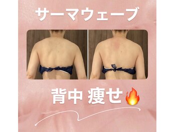 プリマプリート 可児店/背中をすっきりさせたい!