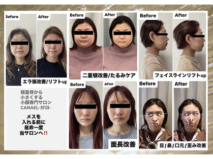 カナエル(CANAEL)の写真