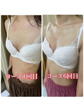 美人バスト 辻堂店/痩せ型の方もバストアップ30代