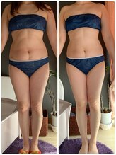 ヨサ パーク コアハート(YOSA PARK CORE HEART)/全身スッキリ