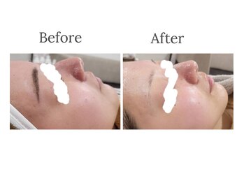 チル アウト(CHILL OUT)/JetPeel