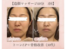 オキシー グレイス 小倉店(OXY Grace)/30代お客様ビフォーアフター