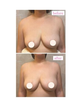 ウンスイスパ(UNSUI SPA)/左右差がある方にも人気です！