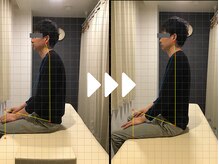 ミライズ整体院 三宮駅前院/事例【20代男性　スマホ首】