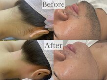 アルゴ 飯塚店(ALGO)の雰囲気（光×waxで即日お悩み解決♪）