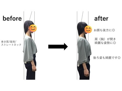 リアナ(LIANA)の写真