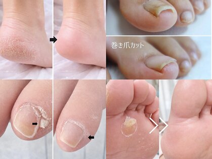 リノ プレミアム(Lino Premium)の写真