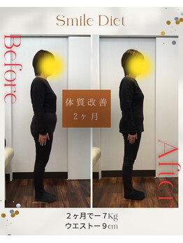 スマイル鍼灸整骨院 南熊本院/スマイルダイエット
