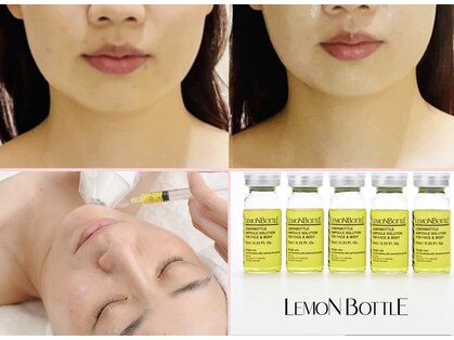 グレイスシャイン(GraceShine)の写真