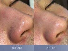 カズキ ハギワラ(Kazuki Hagiwara)