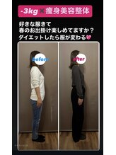ウェルネ整骨院/痩身美容整体マイナス3ｋｇ