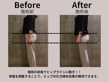 エヌ(N)/骨盤矯正でヒップアップを実現♪