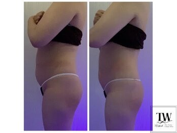 トワ 恵比寿(TOWA)/１回でこの結果(恵比寿痩身)