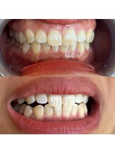 ライトビューティー 池袋店(LightBeauty)/症例写真