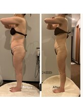 ソウソウビューティー 五反田(Shou Shou Beauty)/ビフォー☆アフター