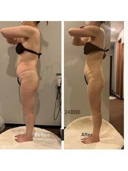 ソウソウビューティー 五反田(Shou Shou Beauty)/ビフォー☆アフター