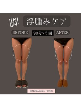 ファミーユ 新宿店/脚ケア/むくみケア