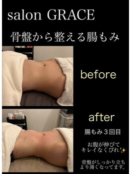 サロン グレイス(salon GRACE)/
