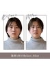 【骨格にアプローチ土台から小顔】￥22,000