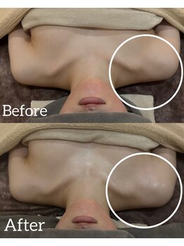 リラ 郡山店(Lilas)/デコルテハンドトリートメント☆