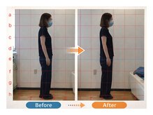 しんぐう整体院/猫背矯正　30代女性