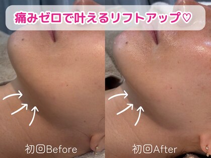 芯美 恵比寿店(shinbi)の写真