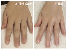 キレイテ 上野店/30代/5回目【ハンドケア稲荷町】