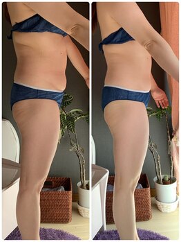 ヨサ パーク コアハート(YOSA PARK CORE HEART)/１回でこの効果