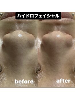 サロン リノ(SALON Lino)/ビフォーアフター