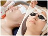 【男女】顔（顔首全体）脱毛　+炭酸パック込み￥５，５００