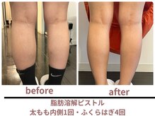 サボラミ(sabor A Mi)/痩身/溶解ピストル　