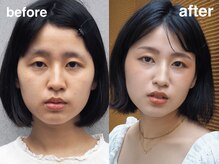 エンバー 吉祥寺(embr.)/【アイブロウ/メイク/眉毛】