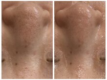 汚れも弾き飛ばし、キュッと引き締めていきます！