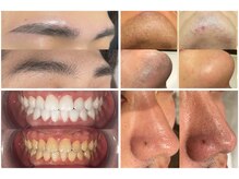 オーマイケア(Oh My Care)/痛みが少なく快適に♪