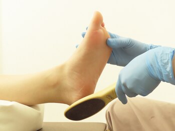 ドクターネイル爪革命 十条店の写真/【角質ケア¥5000】かかとの余分な角質を徹底ケア♪ひび割れやニオイの予防にも◎